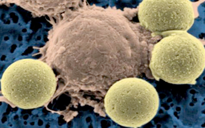 microscope image of T-cell