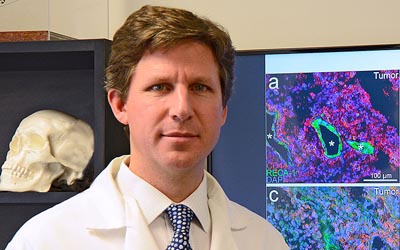 Graeme F. Woodworth, MD, professor of neurosurgery at the University of Maryland School of Medicine and director of the Brain Tumor Treatment and Research Center at the University of Maryland Marlene and Stewart Greenebaum Comprehensive Cancer Center at the University of Maryland Medical Center.
